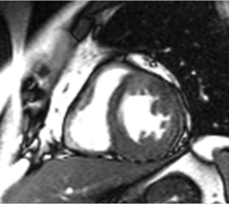 Cardiac MRI short-axis slice used as a fixed image in DFKI registration research.